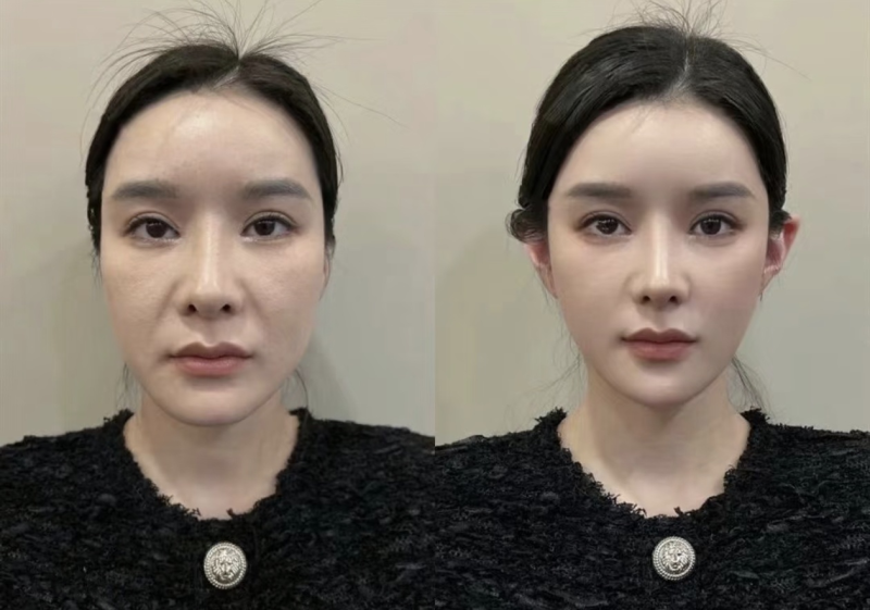 成都美诗沁整形医院真人口碑评价怎么样？