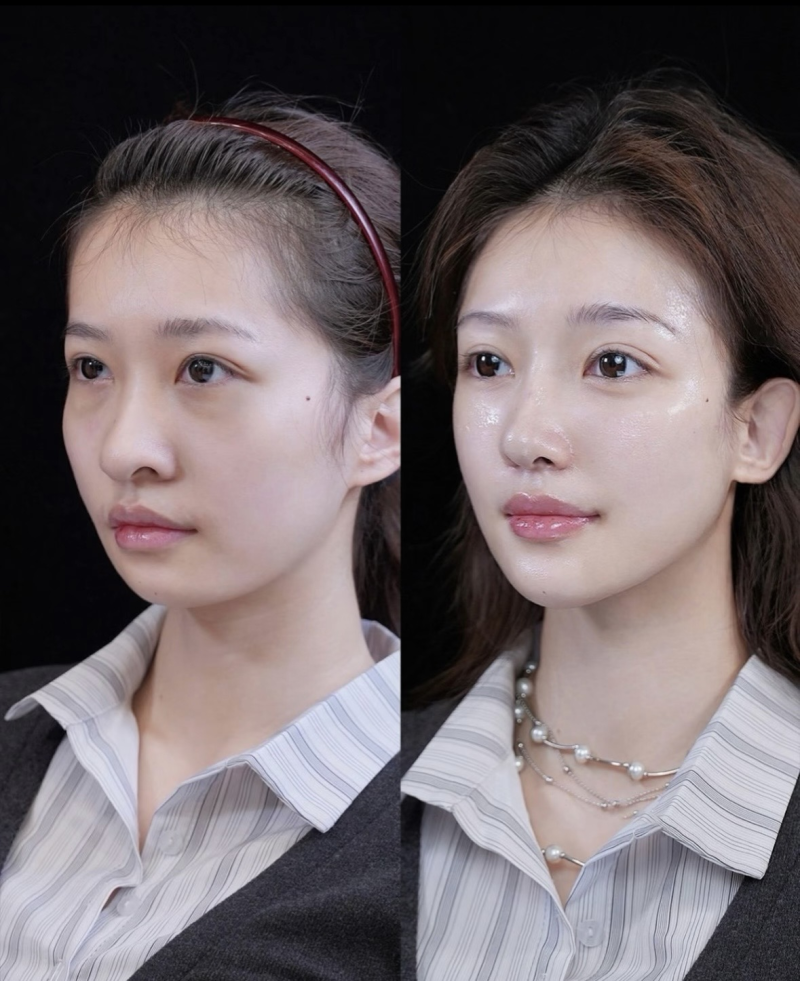 徐爱兵医生技术优势