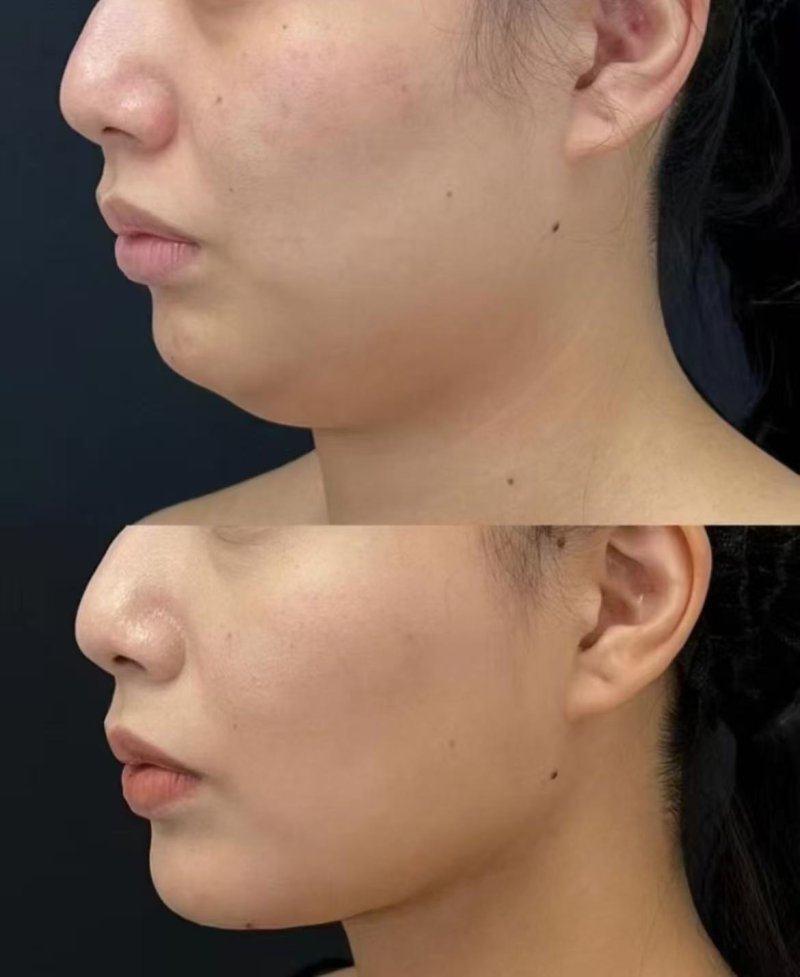 石红卫医生预约挂号