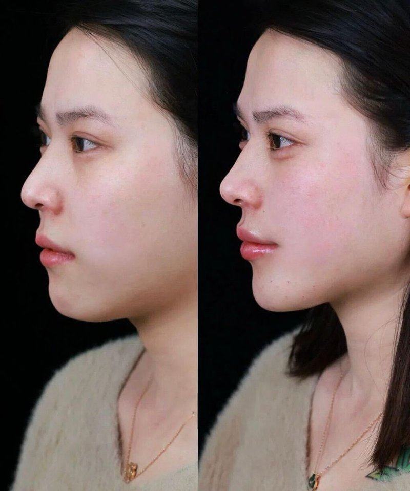 南宁伯克利医疗美容诊所特色项目及技术优势