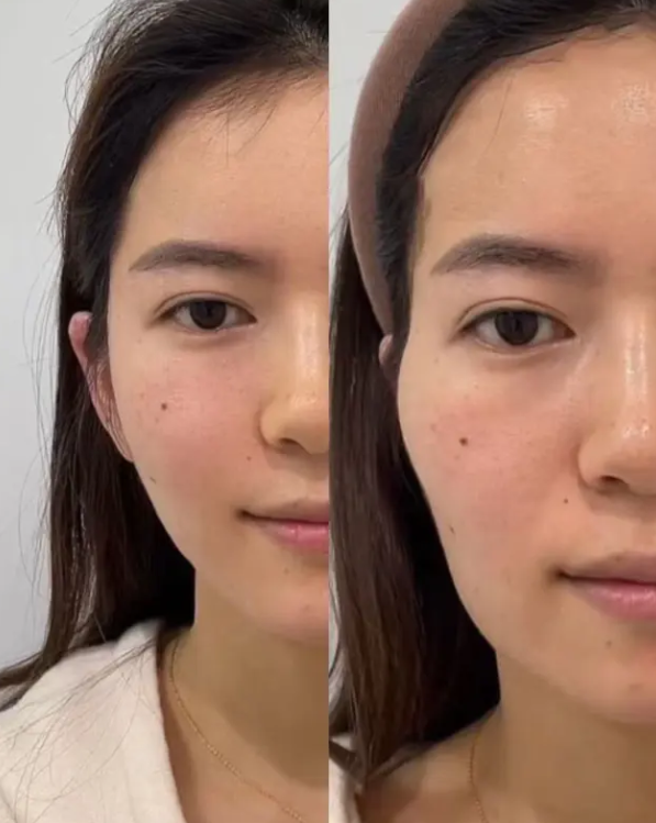 石红卫医生口碑评价及真人实例