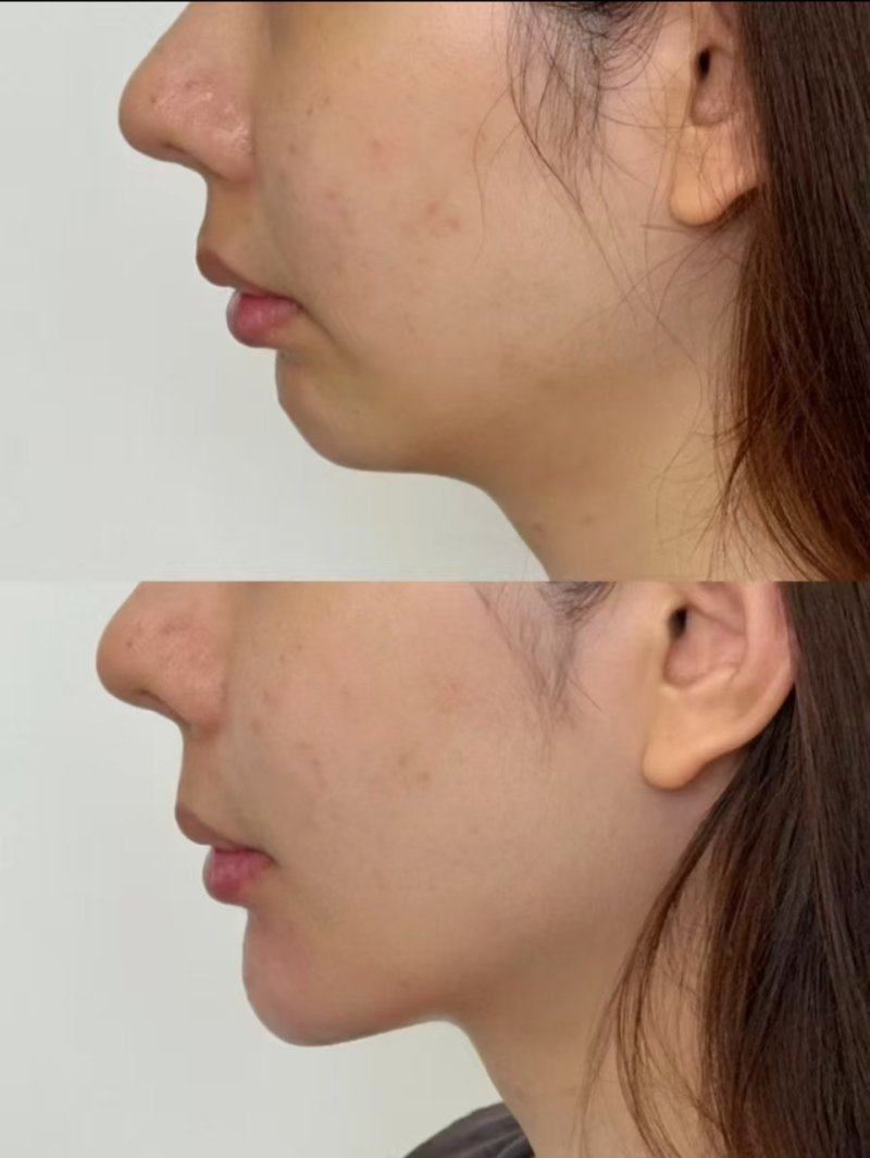 肖敬贞医生口碑评价及真人实例