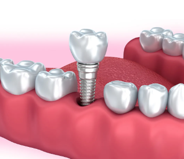 李从鑫医生擅长项目