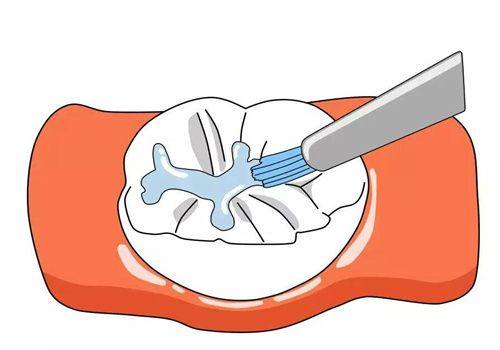 杭州德奥口腔昊轩门诊(滨和路分店)详细的预约挂号方式及流程