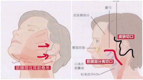 口碑评价及真人实例