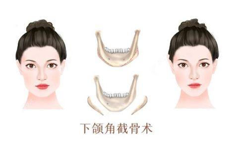 叶进医生执医荣誉