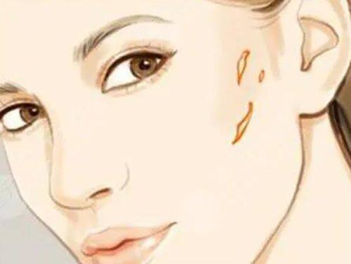 黄益锋医生擅长项目