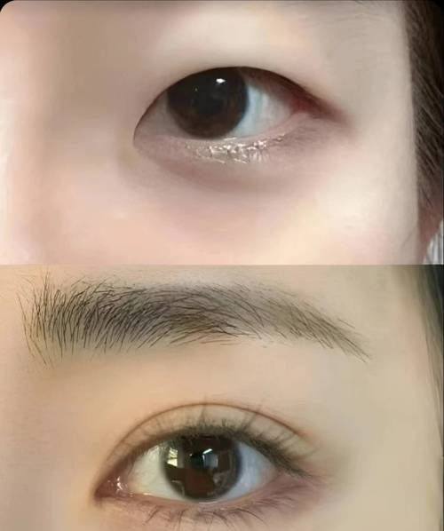 乌鲁木齐艺颜智美整形医院真人口碑评价怎么样？