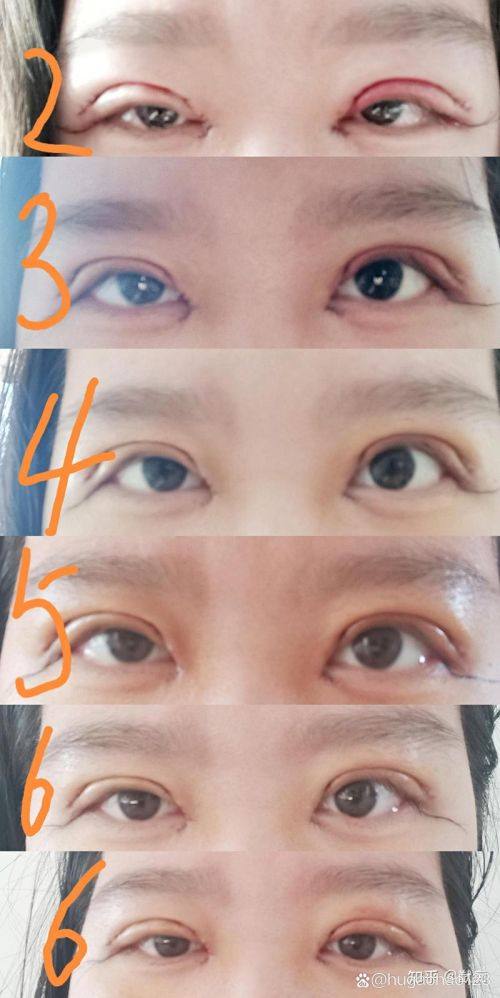 南通富华医疗美容机构真人口碑评价怎么样？