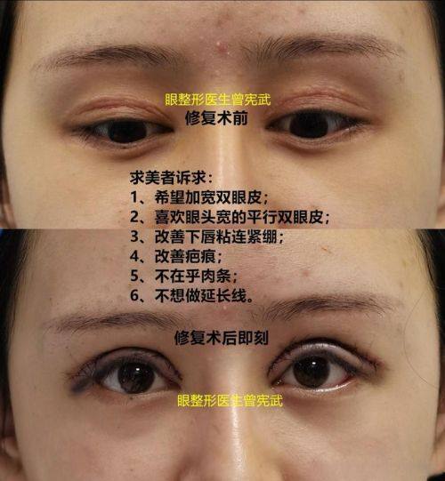 西安同安济医院美容整形科收费价格表/收费标准