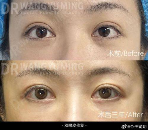 乌鲁木齐艺颜智美整形医院详细的预约挂号方式及流程