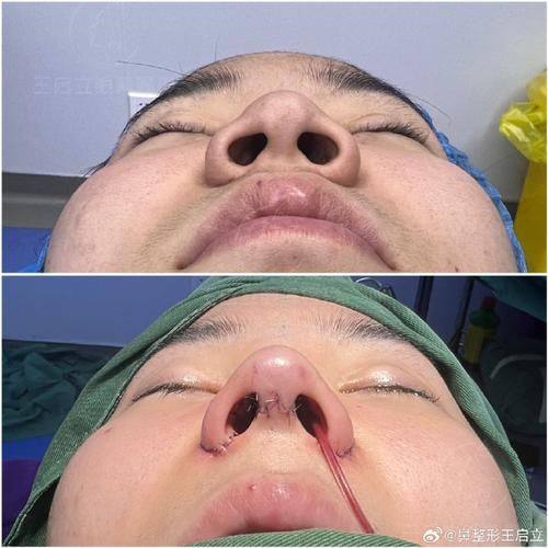 南阳宛城仁康医院医疗美容科真人口碑评价怎么样？