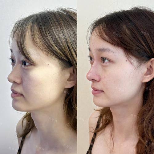 安徽医 科 大学第二附属医院详细的预约挂号方式及流程