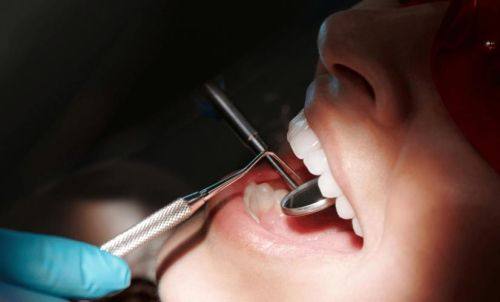 杭州艾维家杭印街口腔门诊部收费价格表/收费标准