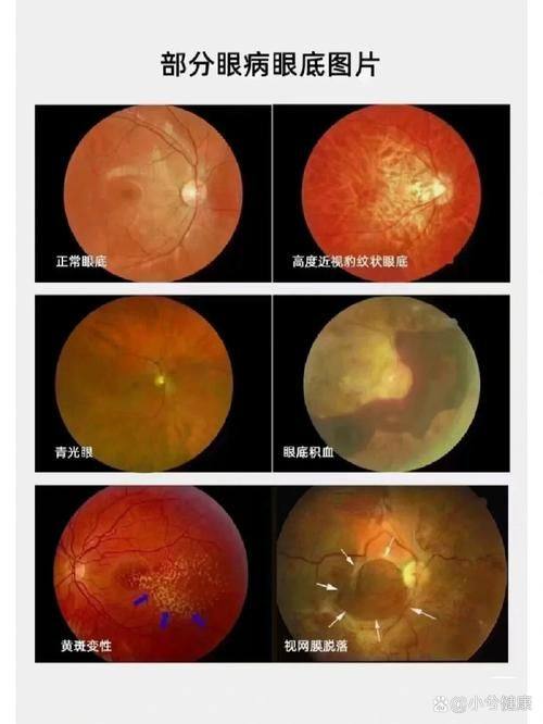 山东大学附属儿童医院眼科简介概述