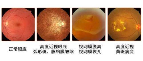 河南省直第三人民医院眼科真人口碑评价怎么样？