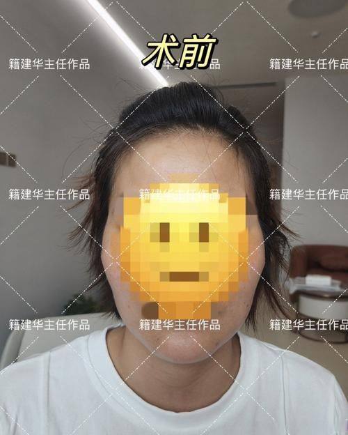 南阳宛城仁康医院医疗美容科收费价格表/收费标准