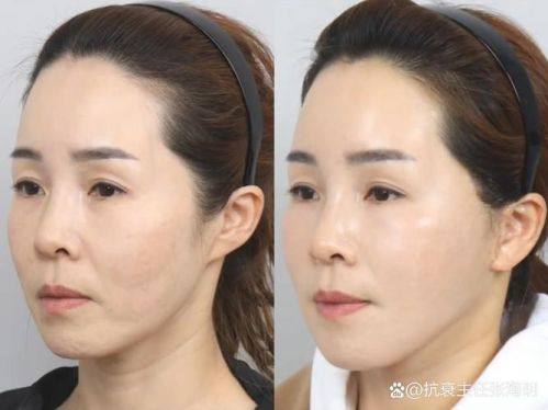 西安同安济医院美容整形科特色项目及技术优势