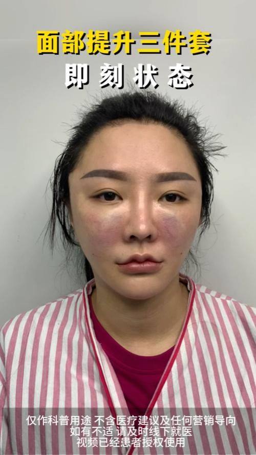 南通富华医疗美容机构特色项目及技术优势