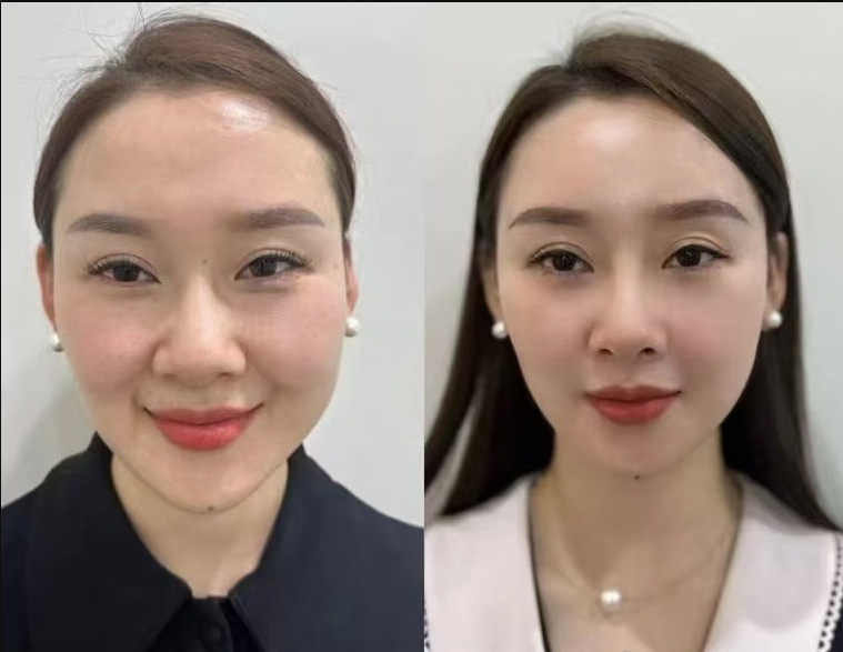 石红卫医生口碑评价及真人实例