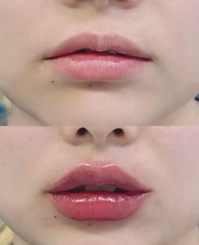 南阳宛城仁康医院医疗美容科是正规医院吗？