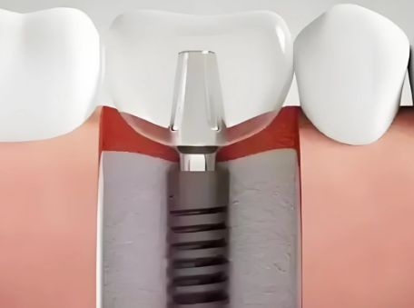 林慧明医生预约挂号