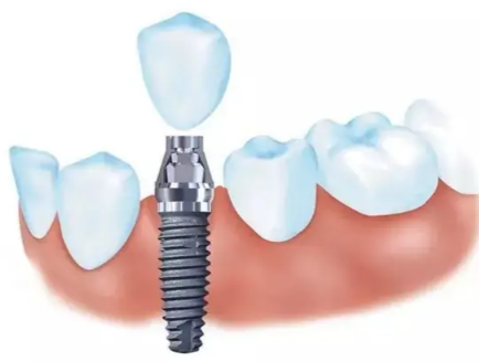 李慧平医生擅长项目