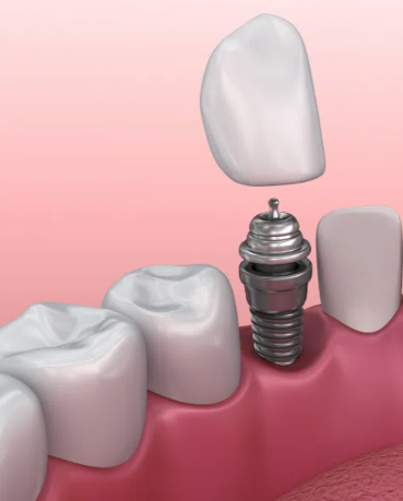 李慧平医生技术优势