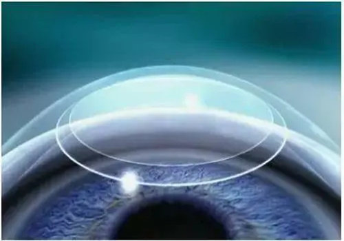 暨南大学附属第一医院（广州华侨医院）眼科是正规医院吗？