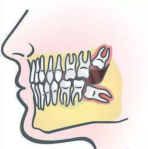 赵蔚琳医生技术优势