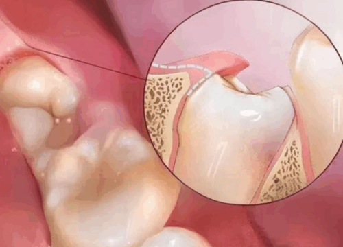 赵中华医生技术优势