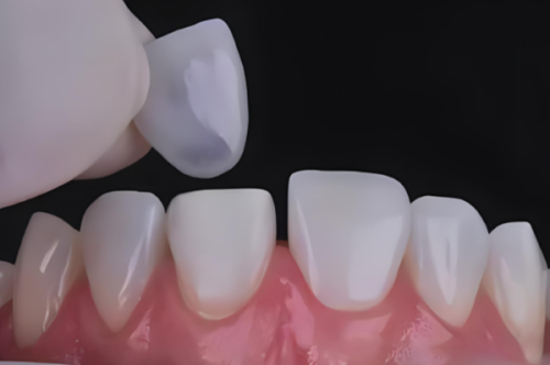 李慧平医生价格表