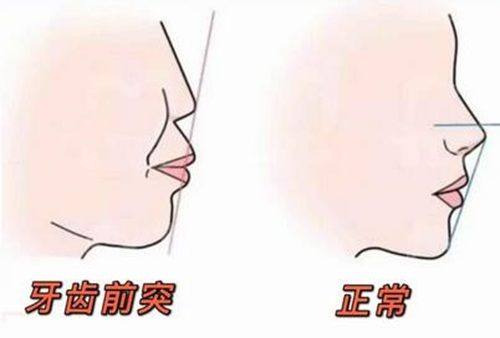 赵蔚琳医生口碑评价及真人实例