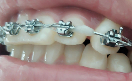 李慧平医生预约挂号