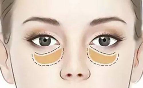 陶革方医生技术优势