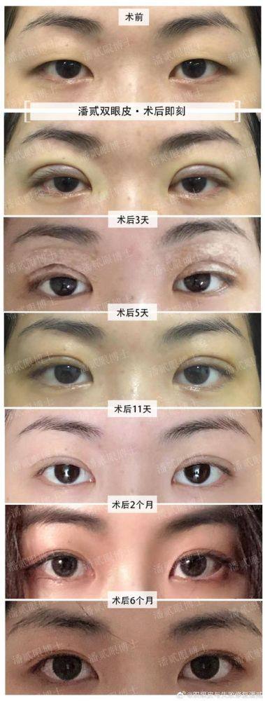 济宁轻美汇整形医院真人口碑评价怎么样？