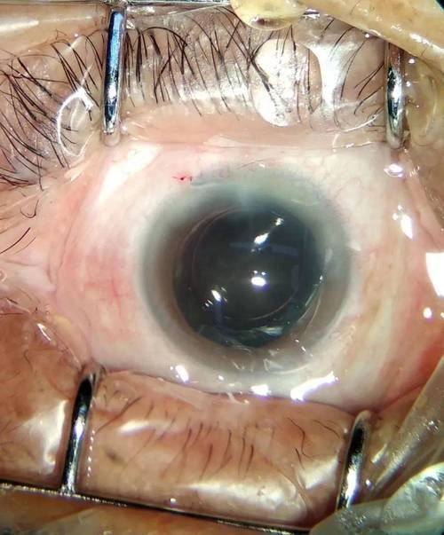 山东省立医院眼科特色项目及技术优势