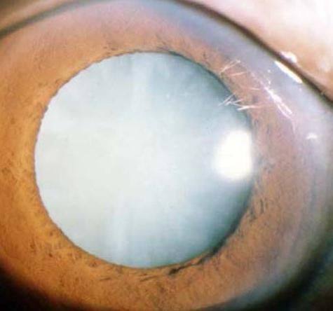 山东省立医院眼科详细的预约挂号方式及流程