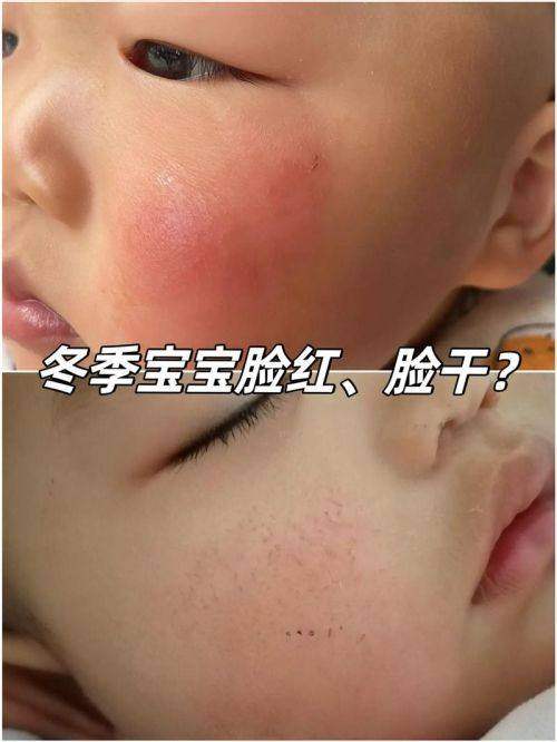 上海未来视界少儿眼科(宝山万达店)地址电话营业时间