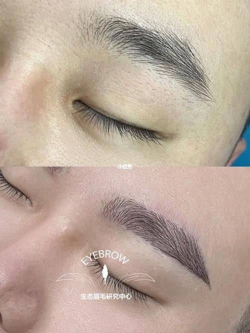 漳州雍禾植发医院收费价格表/收费标准