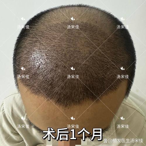 漳州雍禾植发医院地址电话营业时间