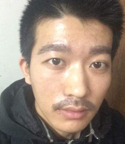 漳州雍禾植发医院真人口碑评价怎么样？