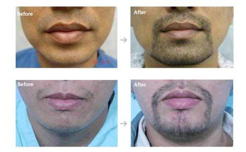 漳州雍禾植发医院医生团队实力强大及骨干医生简介