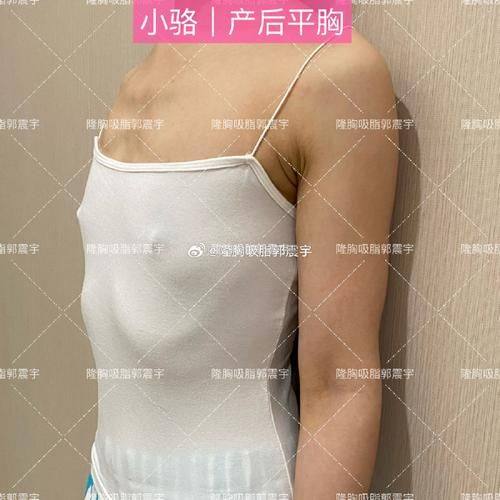 保定名望美容整形中 心真人口碑评价怎么样？