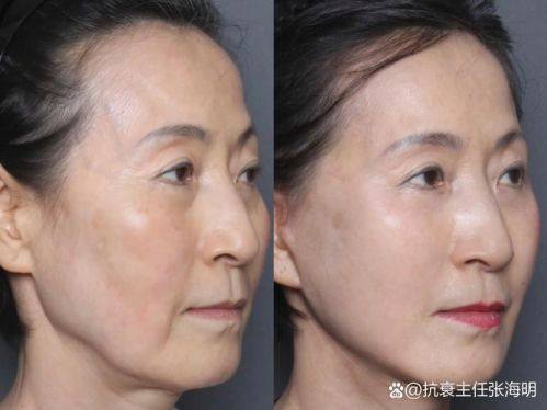 曲阳星灿整形医院地址电话营业时间