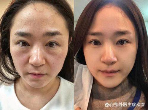 上海沪西医院医疗美容科收费价格表/收费标准