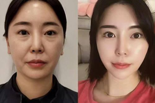 上海沪西医院医疗美容科是正规医院吗？