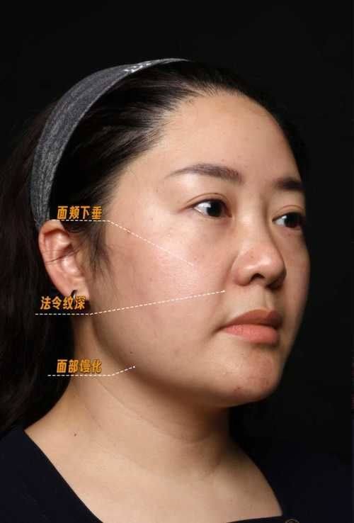 荆门楚伊整形医疗美容收费价格表/收费标准