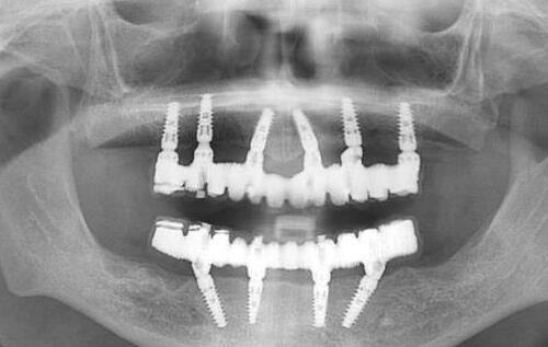 陶革方医生口碑评价及真人实例