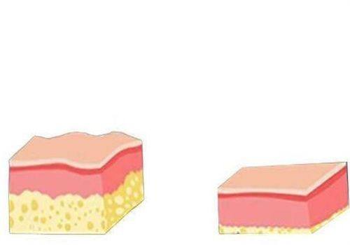 石红卫医生口碑评价及真人实例